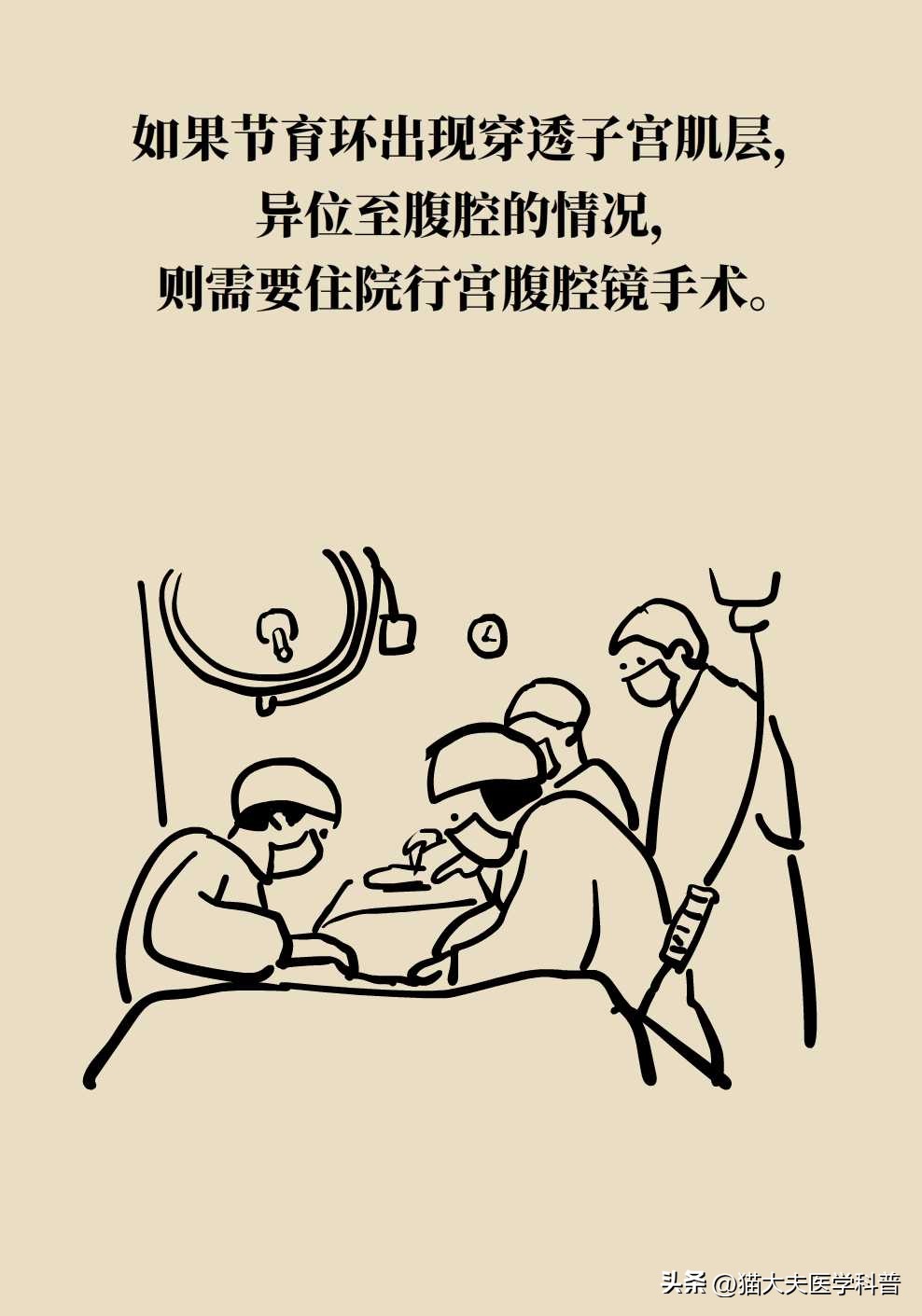 绝经后取环还会怀孕不,绝经后取环还能怀孕吗