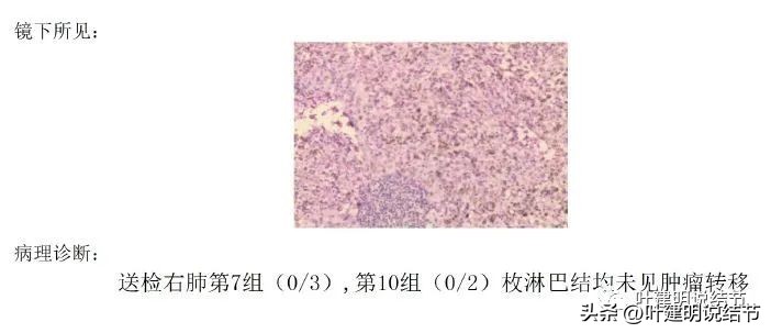 肺癌右中上叶全切,右肺上叶小结节查出是癌怎么办