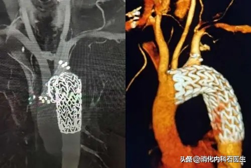不是所有的“胃痛”都能止痛，碰到这3种情况，止痛药不能用