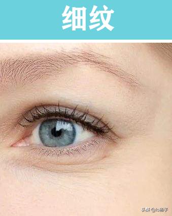 干纹细纹最佳治疗方法,干纹皱纹怎么去除小方法