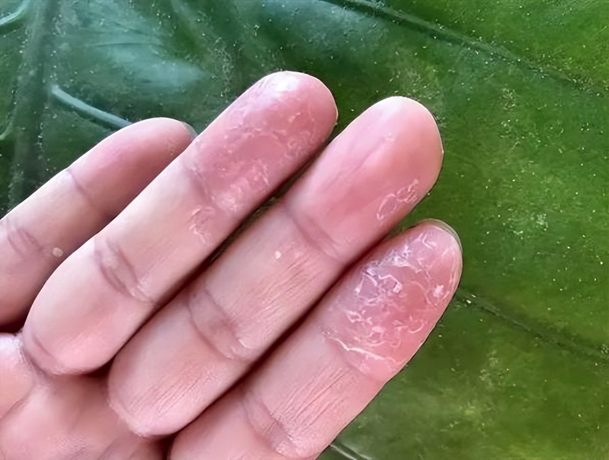 洗洁精对人体到底有没有危害实验,洗洁精对身体有危害吗