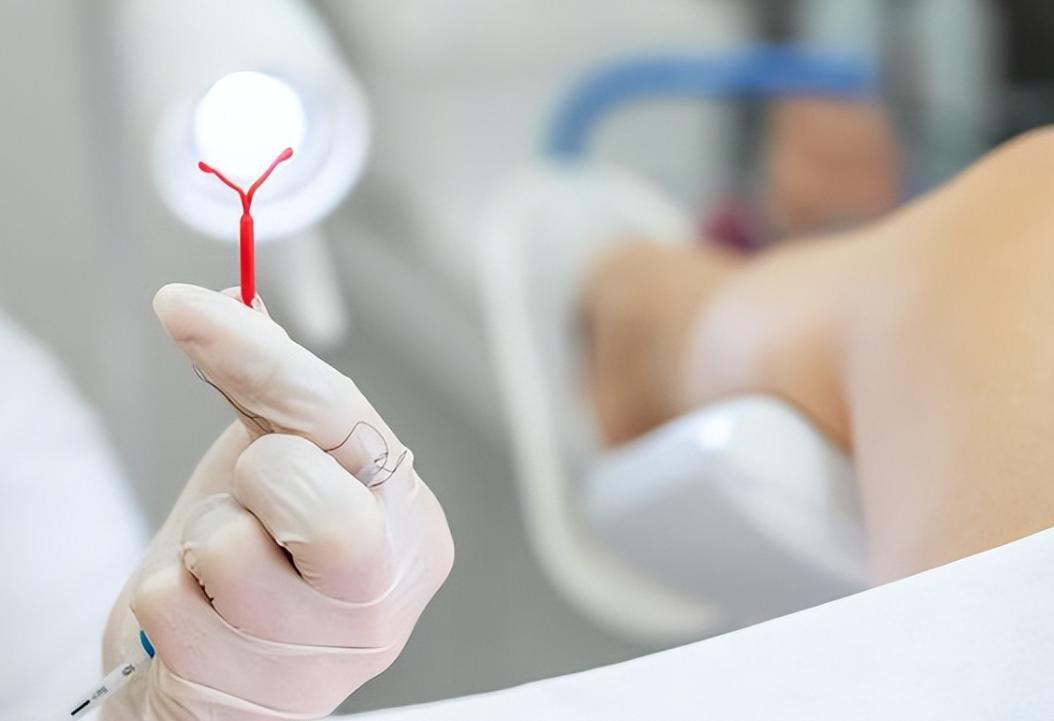 女性上环的全过程，看完心疼了！男女都要好好看看，珍惜眼前人