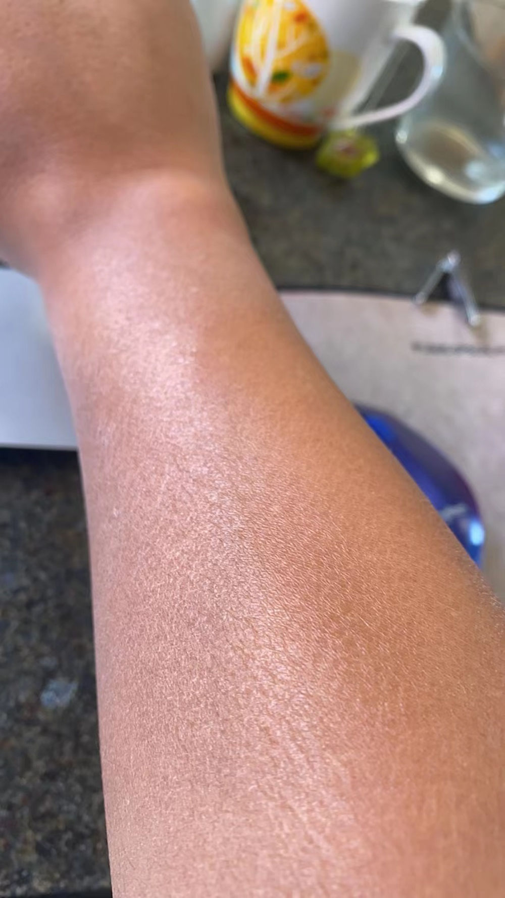 洗完澡身上痒还起皮是怎么回事,洗完澡皮肤干燥起皮浑身痒