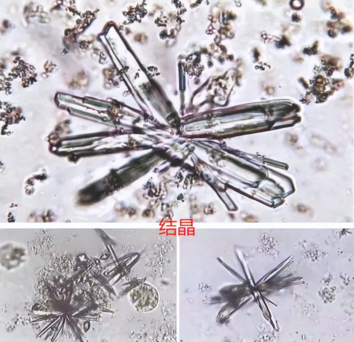 猫咪尿血吃阿莫西林颗粒症状没了,猫咪从楼上摔下来尿血该怎么止血