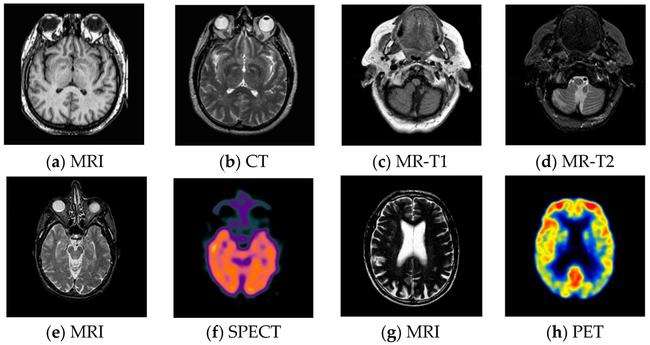 如何提高记忆力最靠谱的方法,记忆力下降的原因和改善方法
