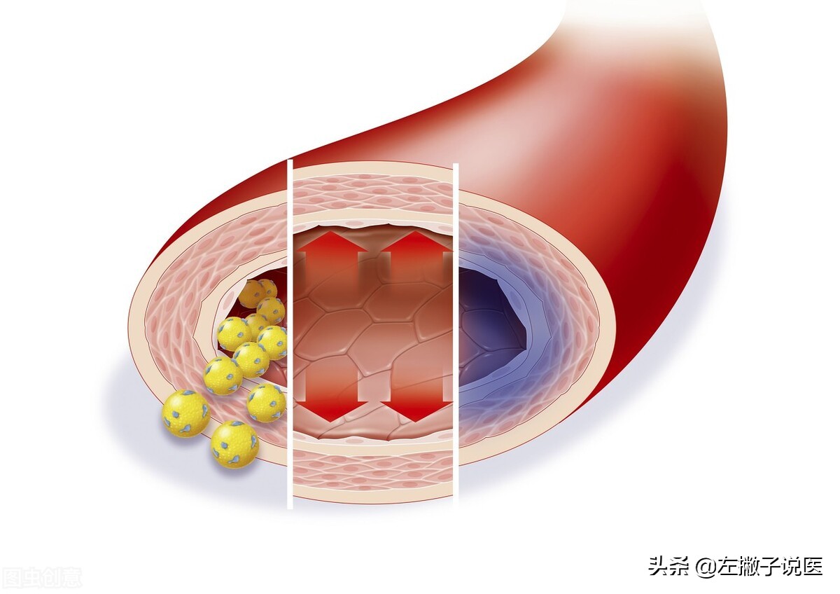 山楂真的可以降压降脂吗,山楂能防癌抗癌么