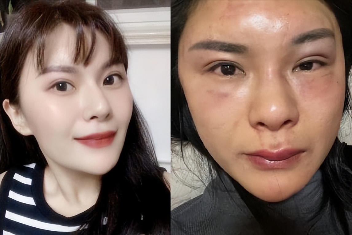 砍杀狗事件处罚,家暴杀狗事件