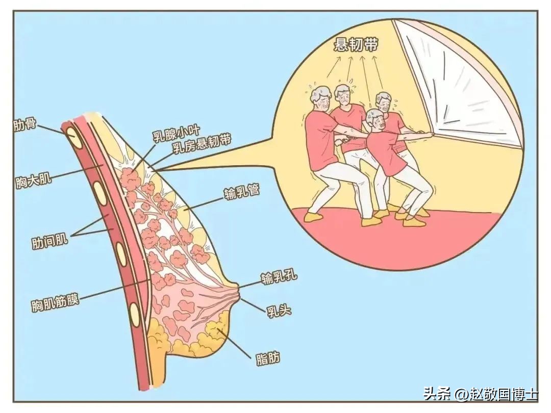 怎样预防面部下垂,如何预防胸下垂松弛