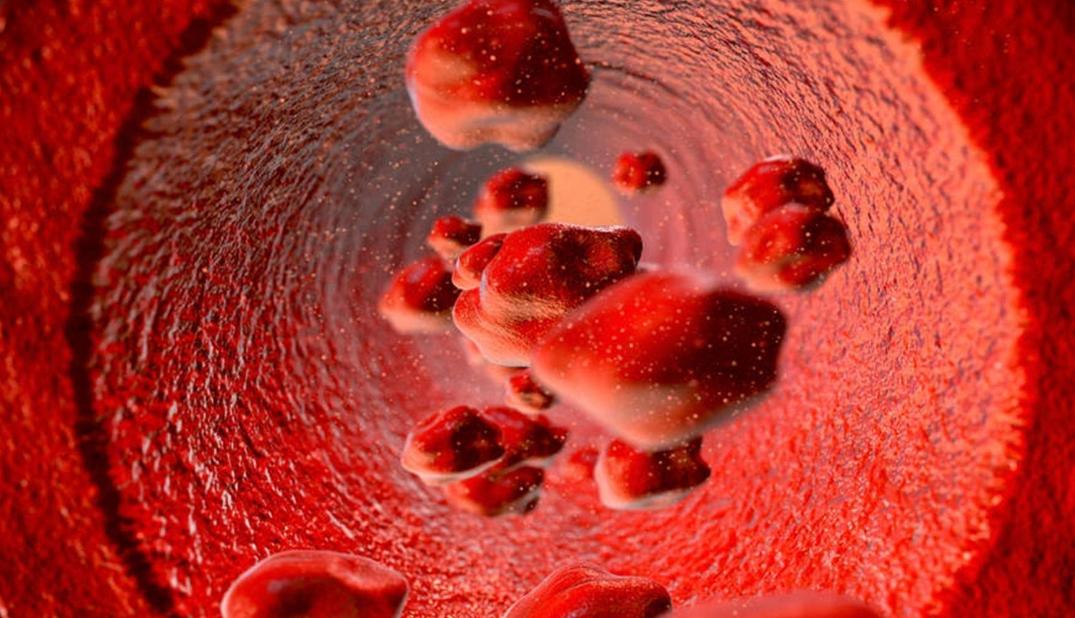 红霉素软膏与姜末祛老年斑有用吗,红霉素软膏能淡化老年斑吗