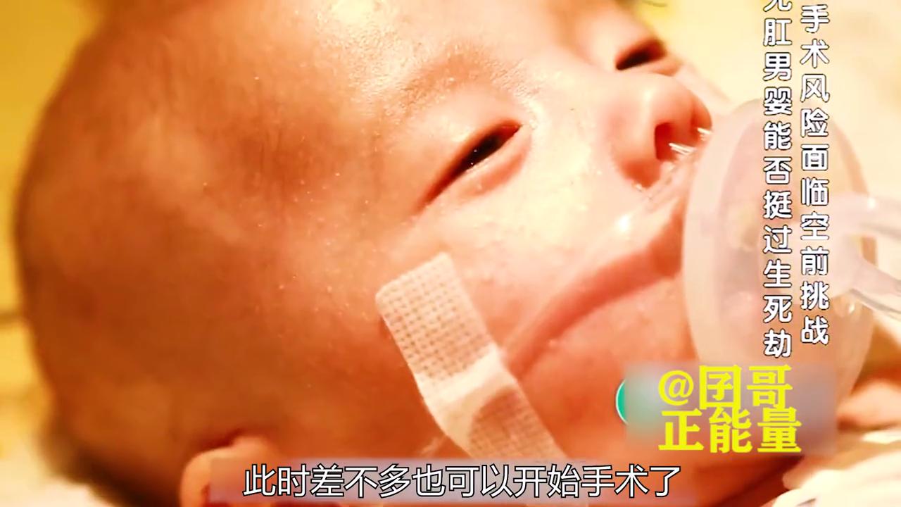 孩子出生不会排便,小孩出生16个小时没有排便