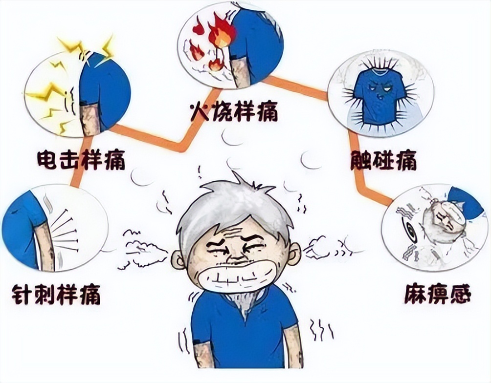 临淄区带状疱疹疫苗接种地方,潍坊带状疱疹疫苗