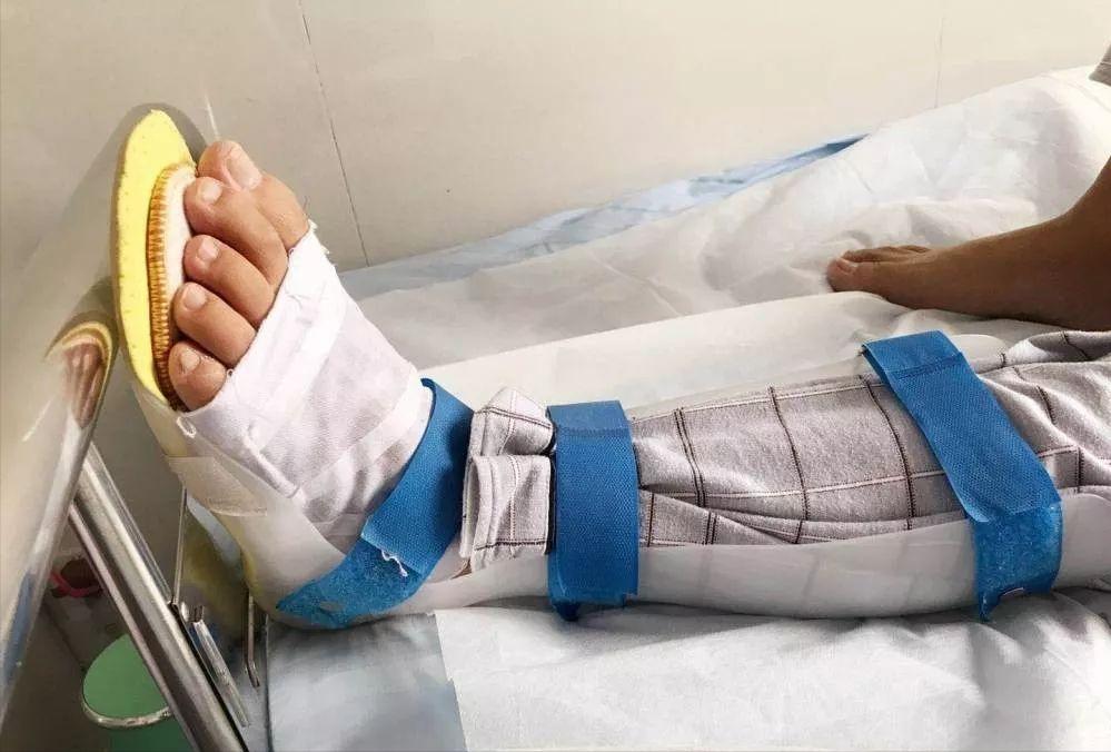 偏瘫后足内翻严重怎么康复锻炼,偏瘫患者足内翻康复训练视频