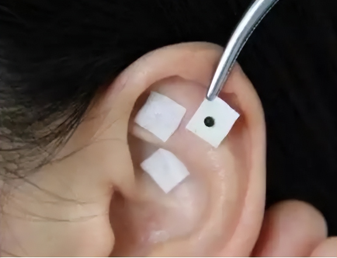 良性的乳腺肿块不动手术会癌变吗,乳腺结节良性三级严重吗会癌变吗