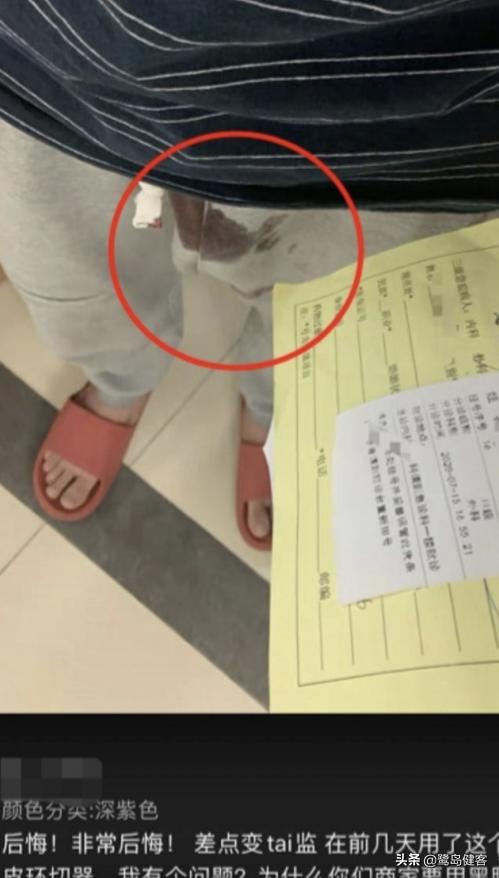 自己动手切包皮靠谱吗,自己动手包皮切除