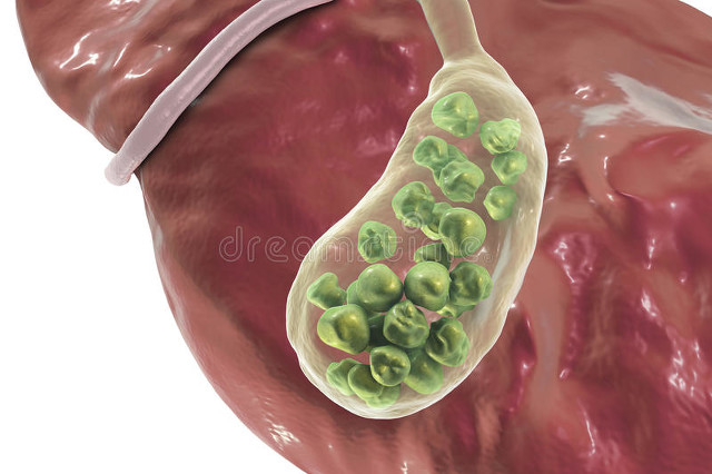 女性身体构造很特殊，憋尿的危害更大！