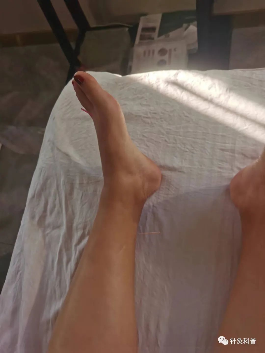 喉咙热有烧灼感针灸,舌头有烧灼感针灸方法