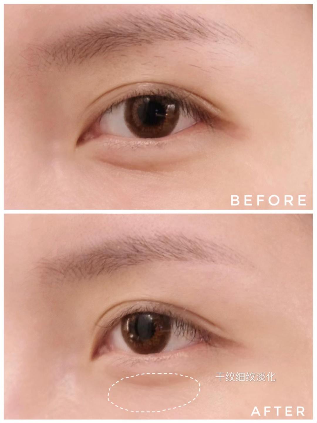 眼霜擦不擦的区别,眼霜擦跟不擦区别