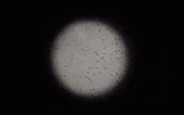 在游泳池里放入蝌蚪会怎么样,游泳池里会有尿吗