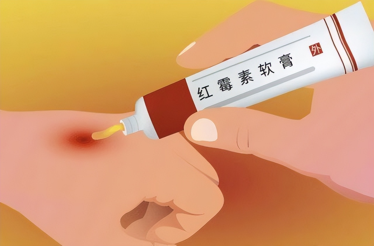 红霉素软膏淡斑真的有效吗,2块钱的红霉素软膏能祛斑吗