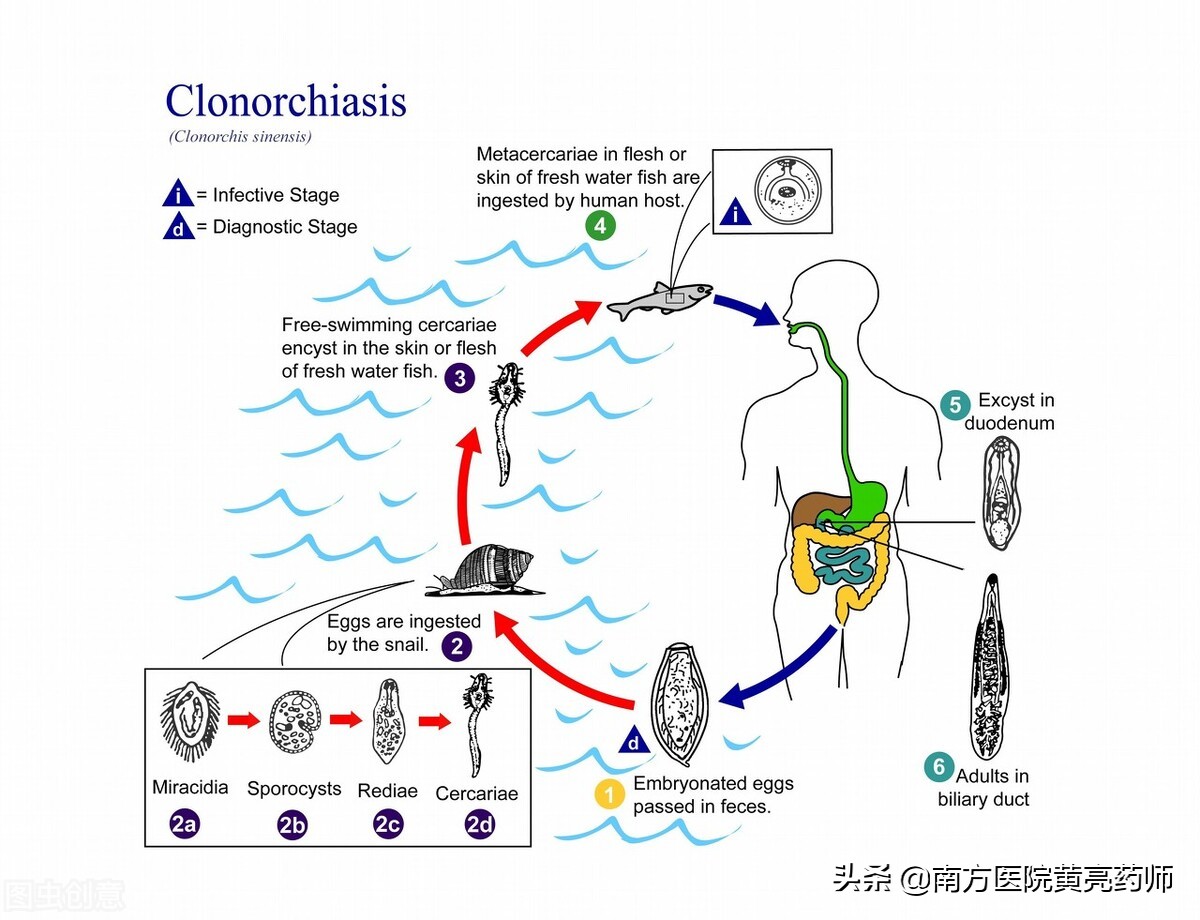 喜欢吃鱼生怎么防止肝吸虫,吃生鱼片怎么确定自己感染肝吸虫