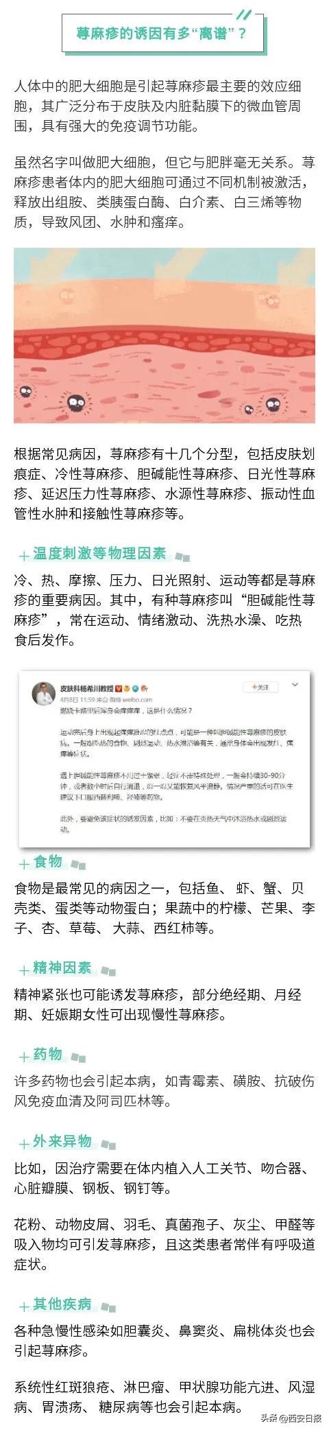 对自己的汗过敏是种怎样的体验,对汗过敏是什么症状