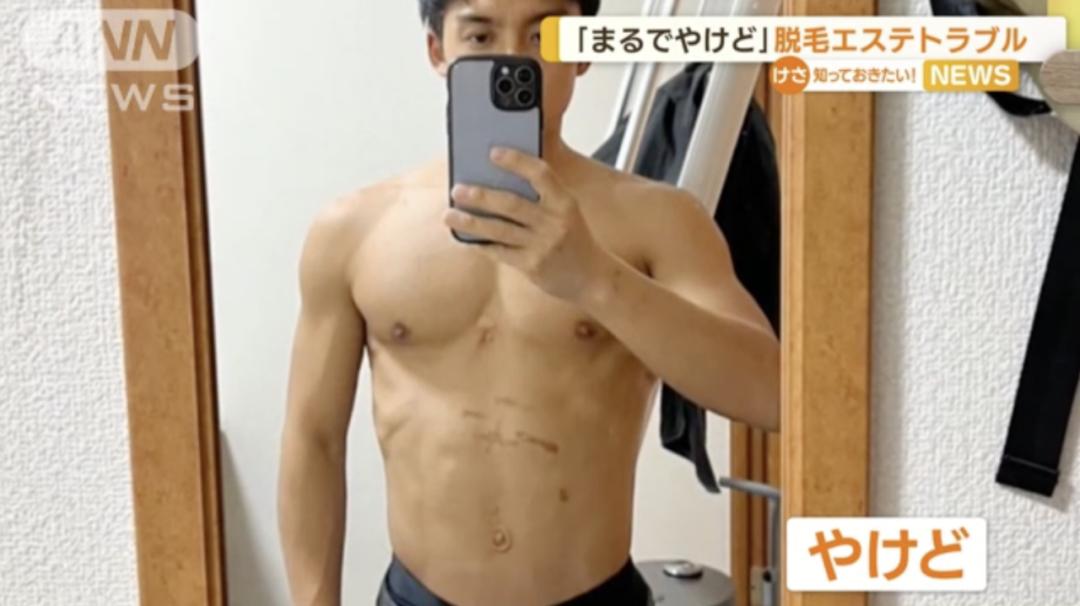 无良女医生非法做手术,女子被假医生做隆胸手术