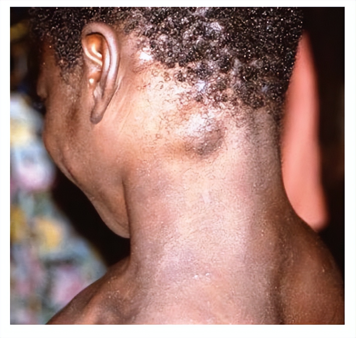 who危险度等级,who风险级别