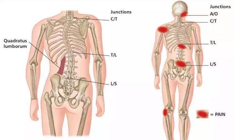 骨盆旋移症就是骨盆不正,怀疑骨盆不正查什么科