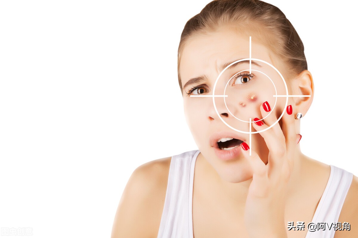 女孩脸上长痘痘最好的治疗方法,女孩脸上长痘痘的原因及治疗方法