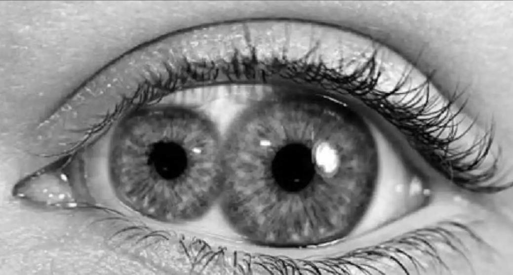 历史上双瞳的人有哪些,什么是古人说的双瞳