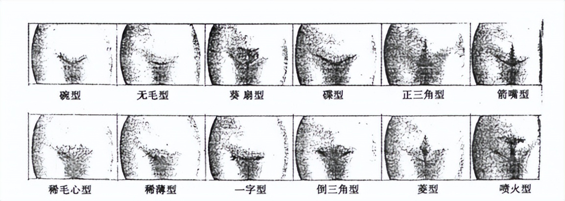 阴毛多或者少，代表了什么？医生直言：这几大作用，别视而不见