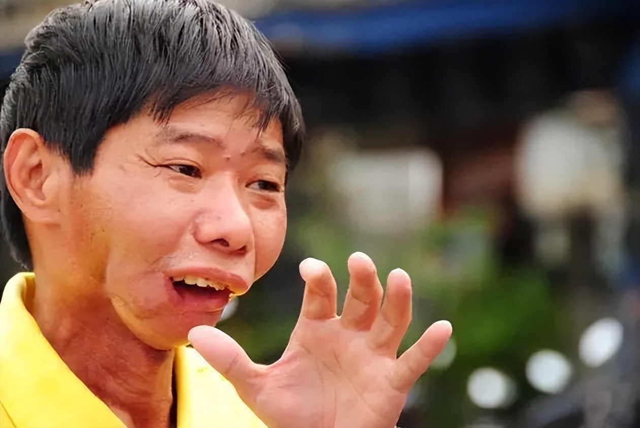 小伙一天吃五六包槟榔导致死亡,28岁小伙一天五六包槟榔