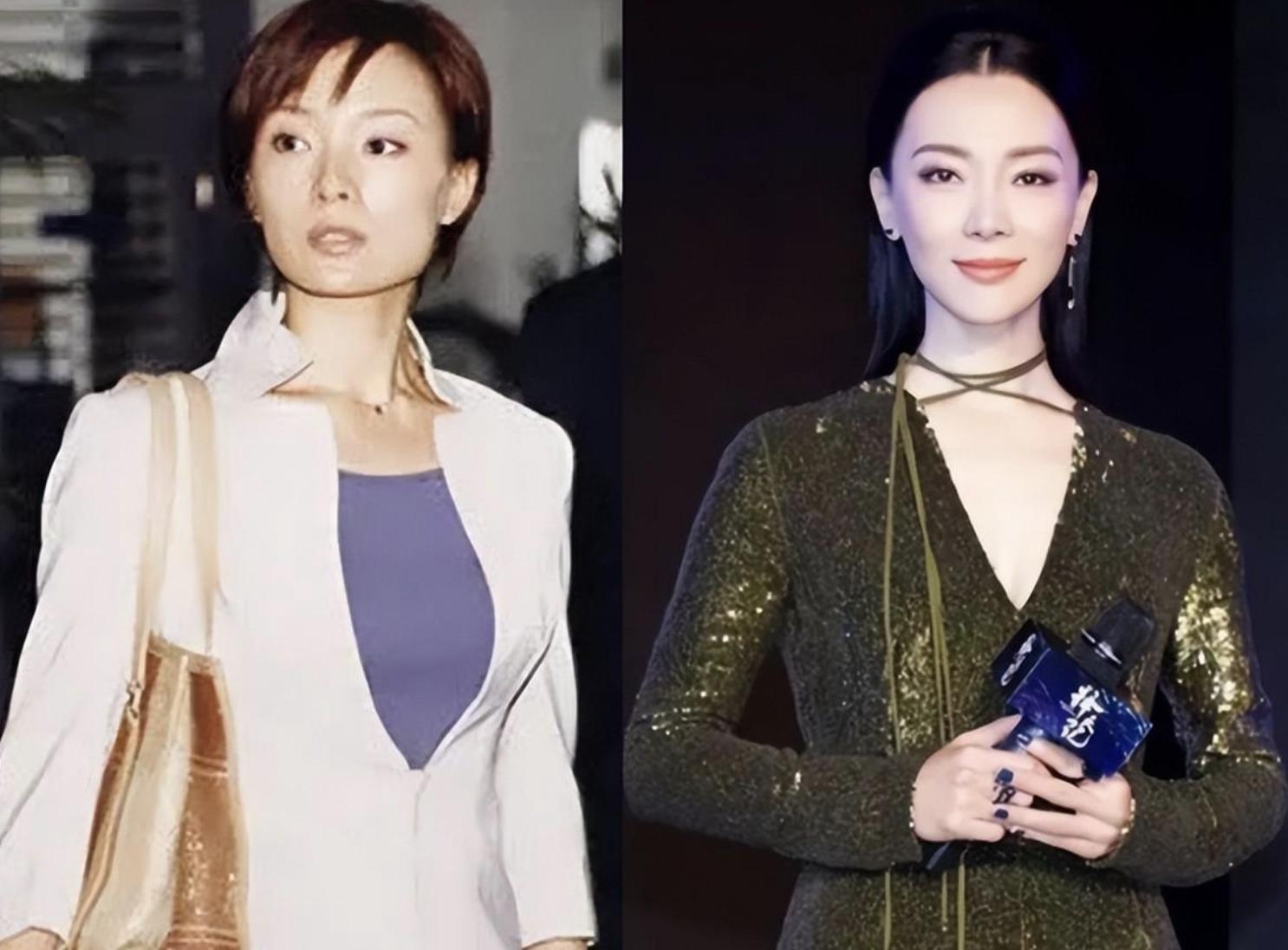 娱乐圈还有哪些假臀假肌肉,假臀假肌肉假肩膀的明星们