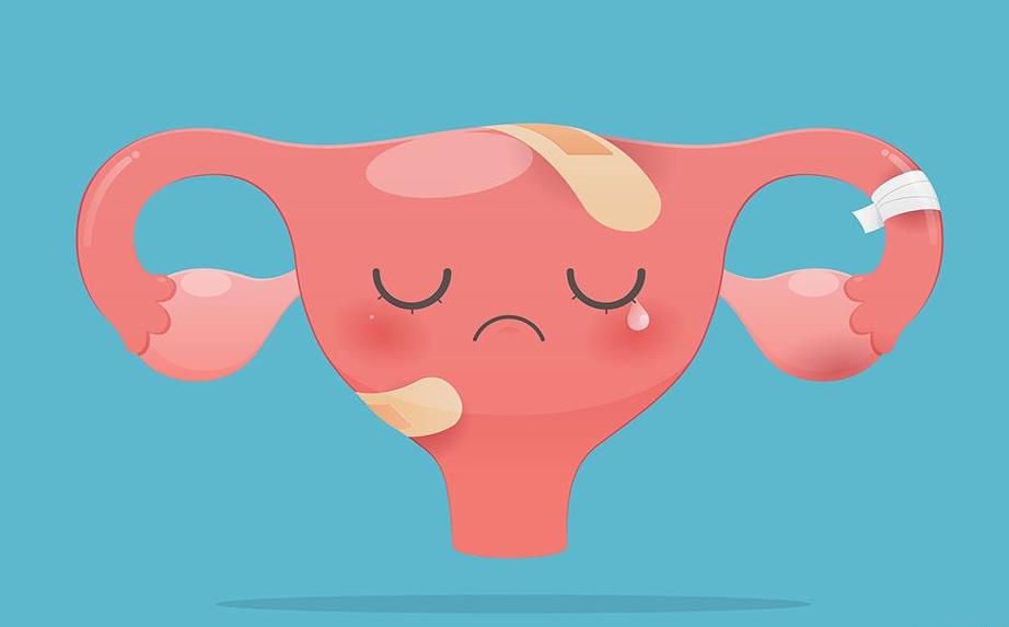 女人为什么反复长子宫肌瘤,如何防止长子宫肌瘤