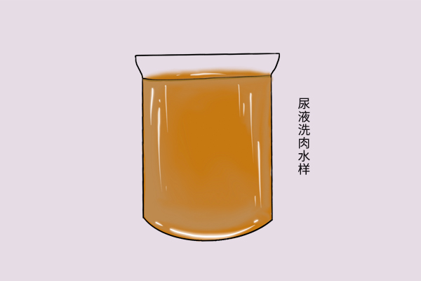 眼屎多口干鼻子干是什么原因,鼻子干眼屎多是哪个部位上火