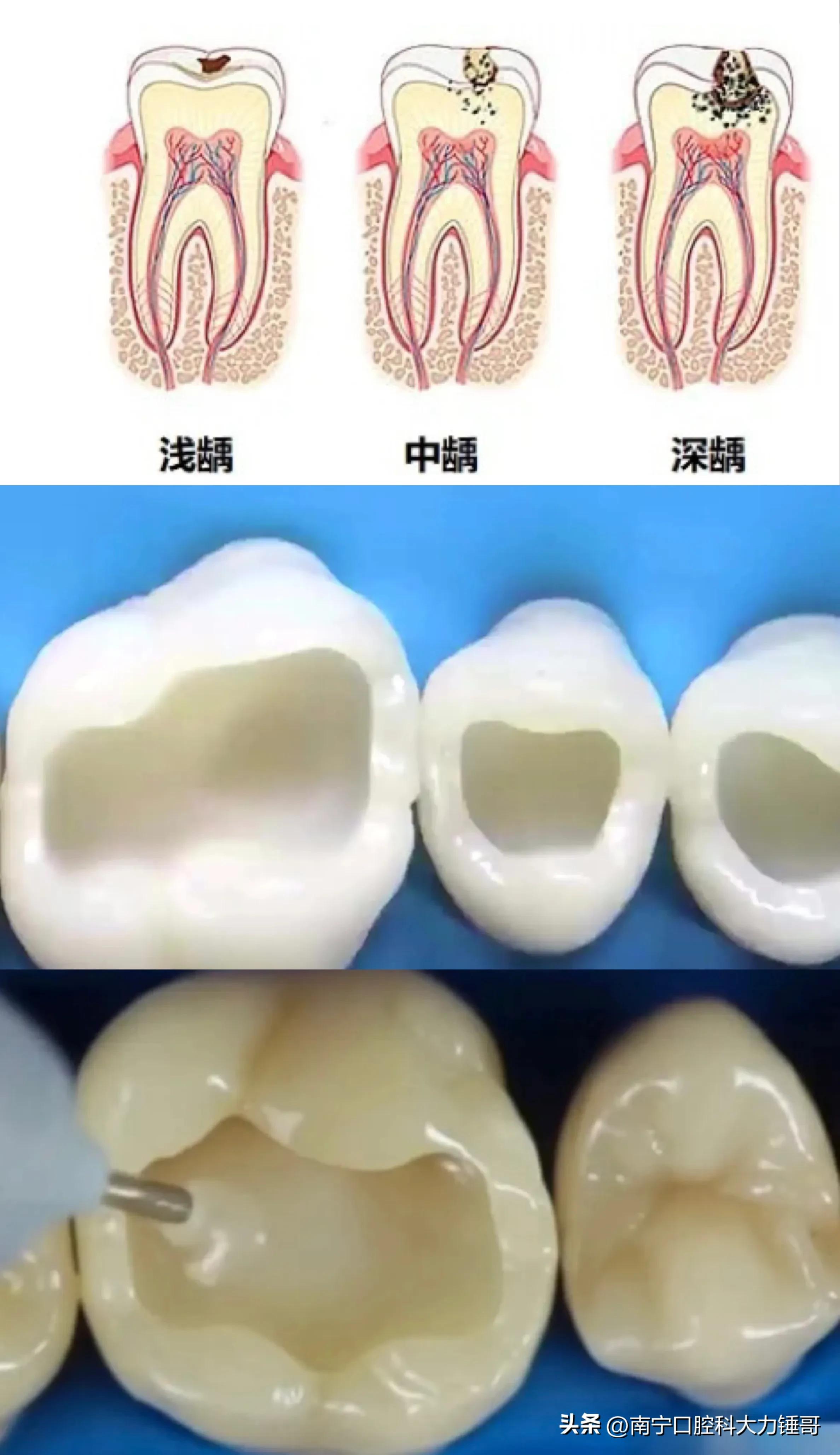 一颗牙得花多少钱,看一次牙