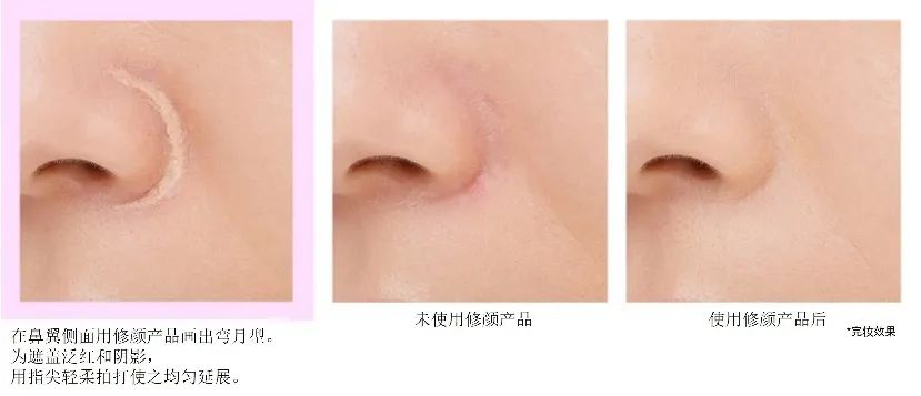 如何化妆消除法令纹最有效办法,泪沟重法令纹重鼻子塌怎么化妆