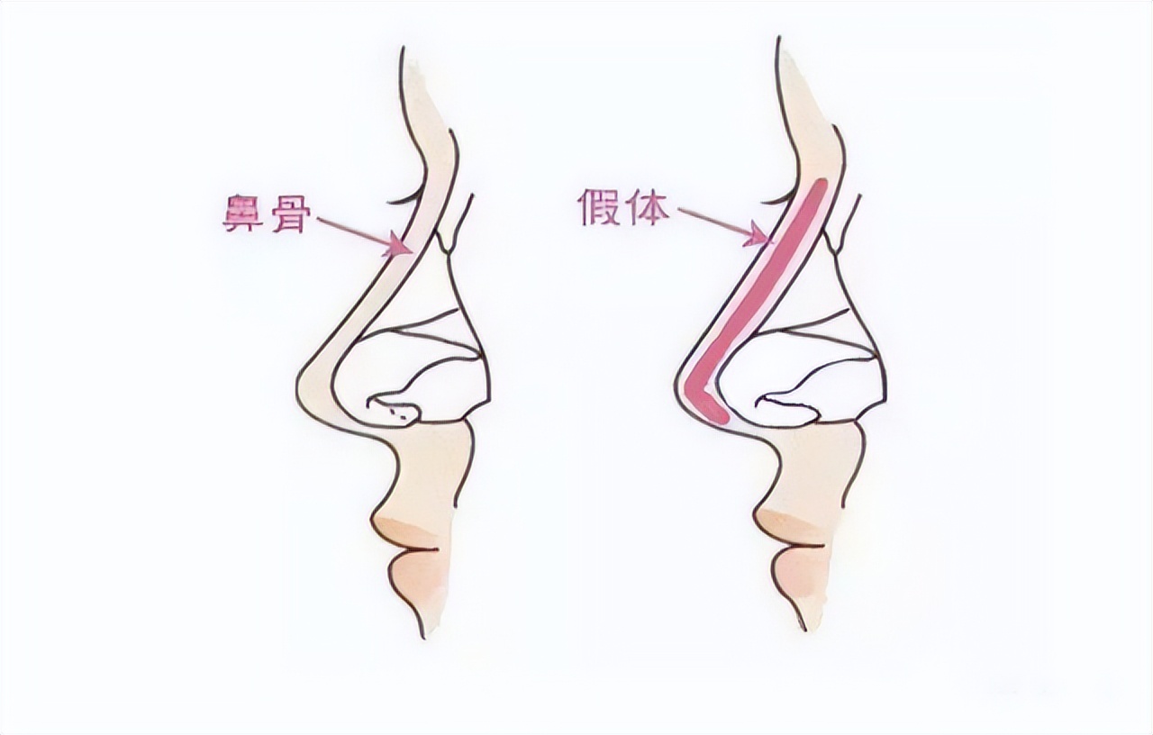 “悬胆鼻”是鼻中之王，看着就一脸富贵相，老了后更显气质优雅