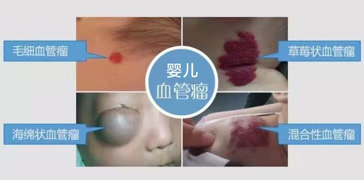 孩子身上出现不明红点,0-6岁的宝宝家长都应该关注哪些