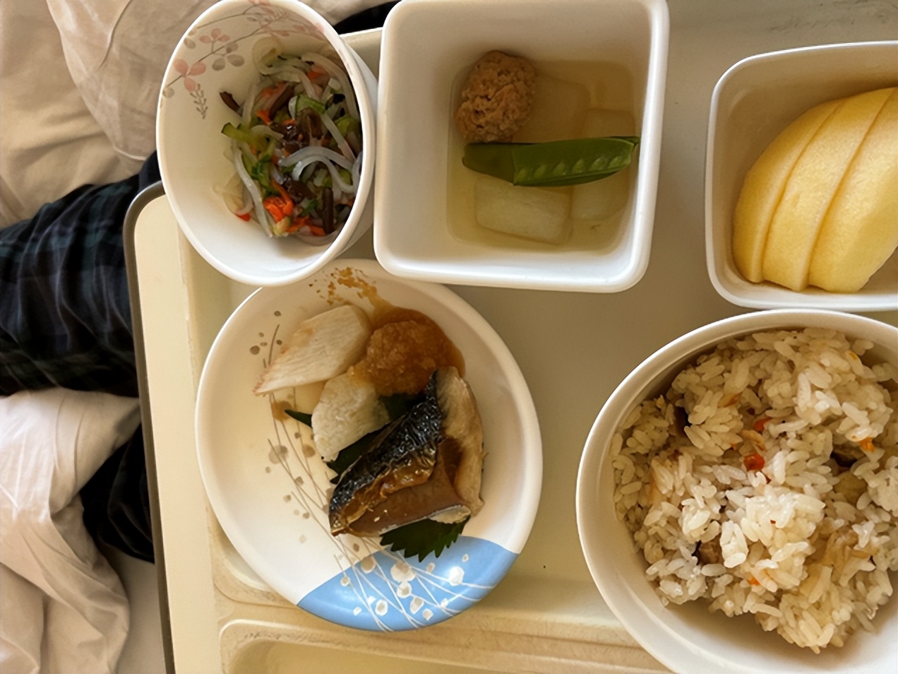 割了痔疮好像尿不干净一样,割完痔疮之后为啥会头疼