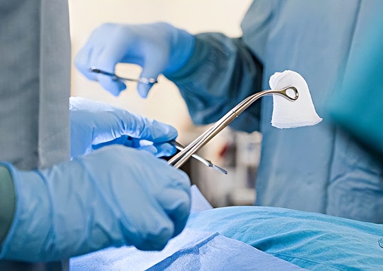 胆囊息肉切除后遗症怎样才能恢复,手术切除胆后有什么影响