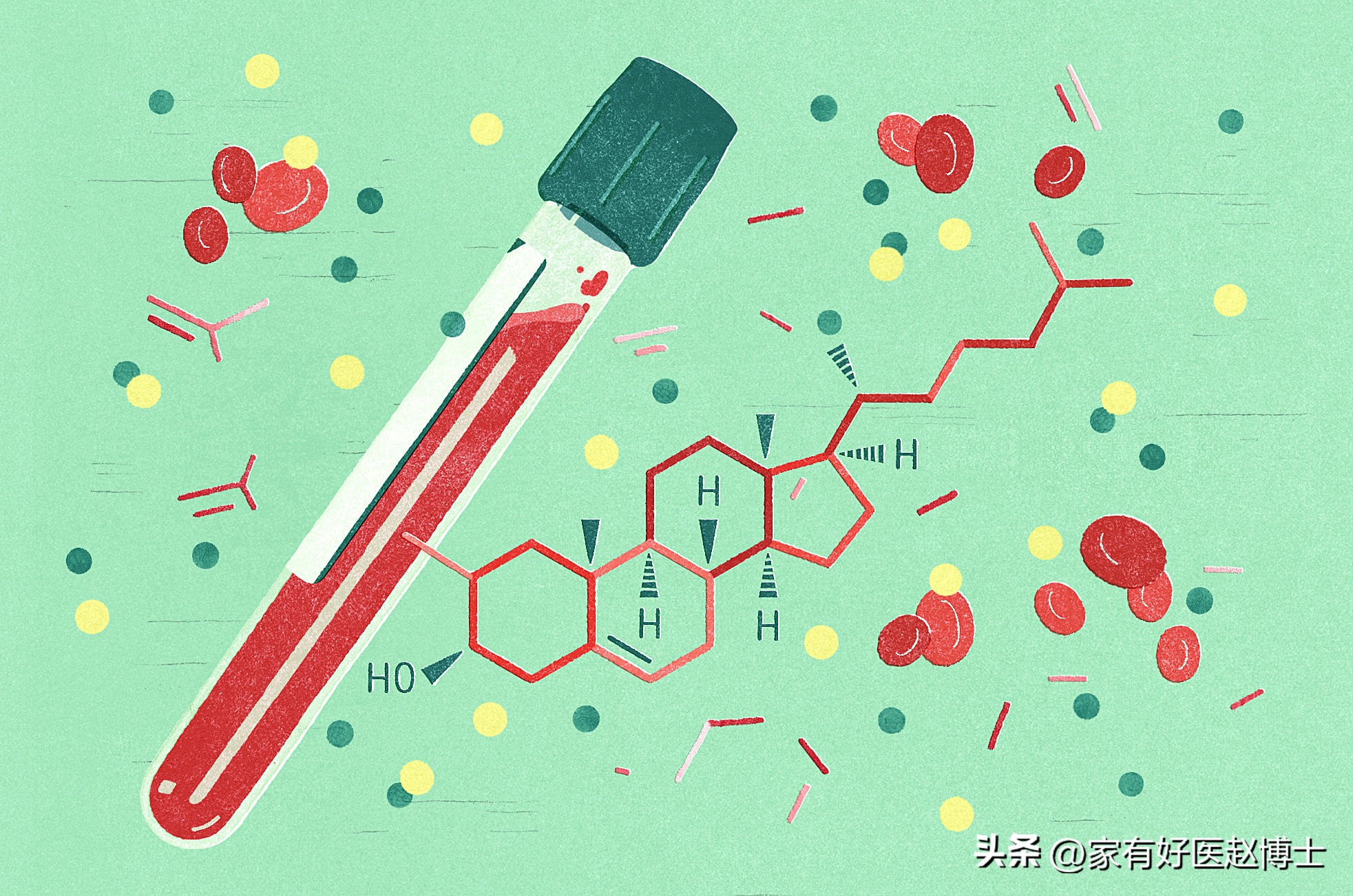低密度胆固醇ldl偏高需要注意什么,hdl胆固醇偏低是什么意思