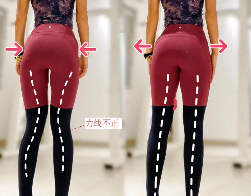 上下楼梯时膝关节痛的原因及康复方法