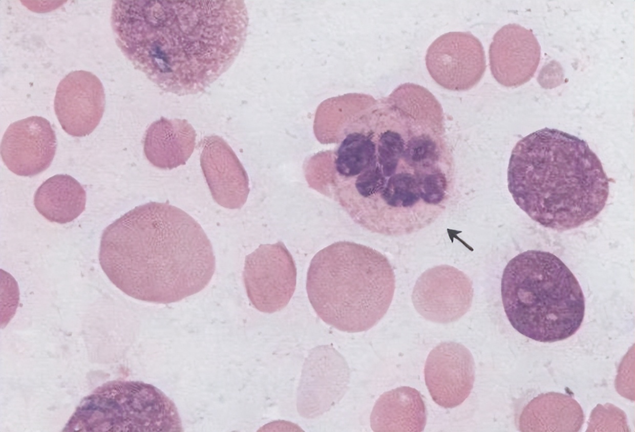 几块钱100片的维生素b12治什么病,几块钱一瓶的维生素b12效果怎么样