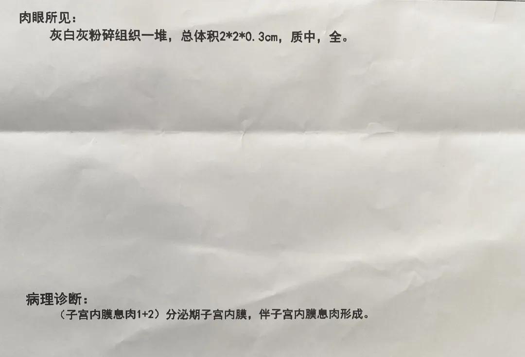 子宫里长了一堆肉球？一直漫不经心的我被吓懵
