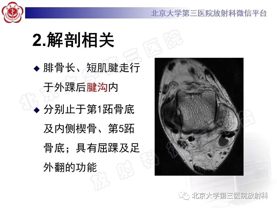 好文分享续集,腓骨肌腱脱位手术价格