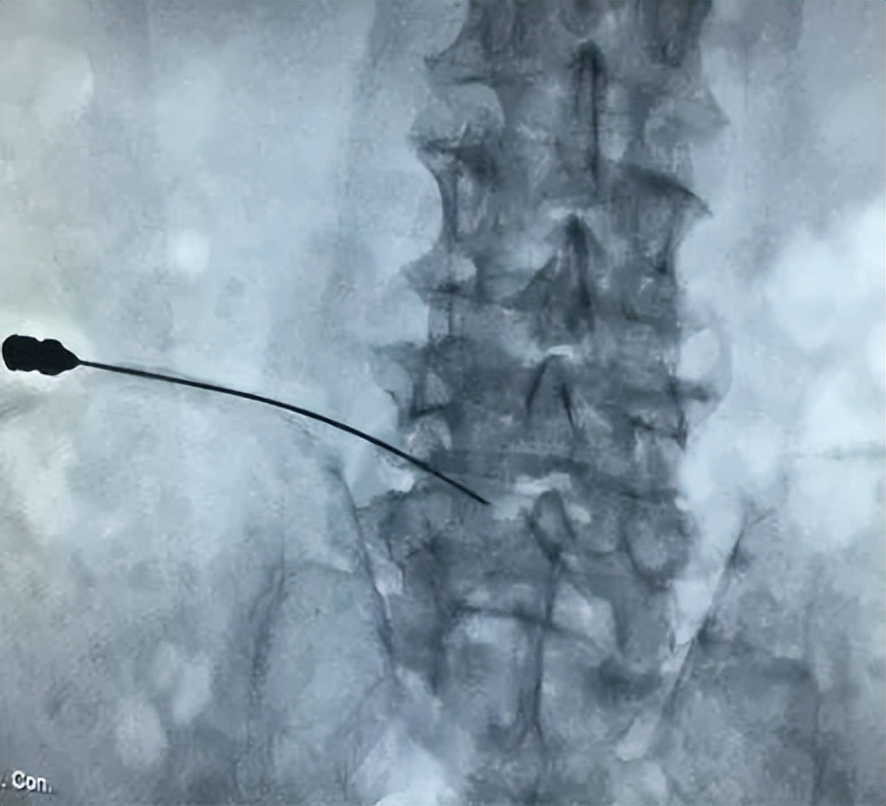 针尖上的艺术,针尖上的艺术效果