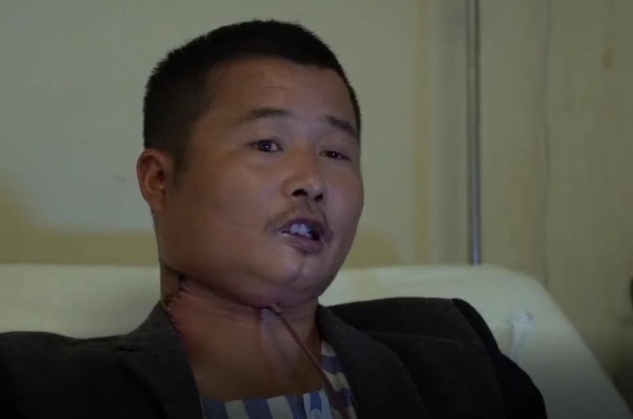 槟榔危害性有多大安全性又有多大,槟榔危害到底多可怕