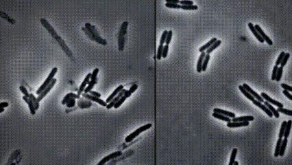 运动神经元显微镜观察内容与结果,显微镜下观察神经元的判断依据