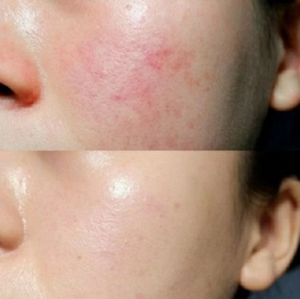 孕期补水保湿水乳推荐排名第一,孕期爆款水乳红黑榜